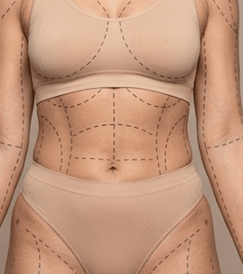 Full Body Contouring